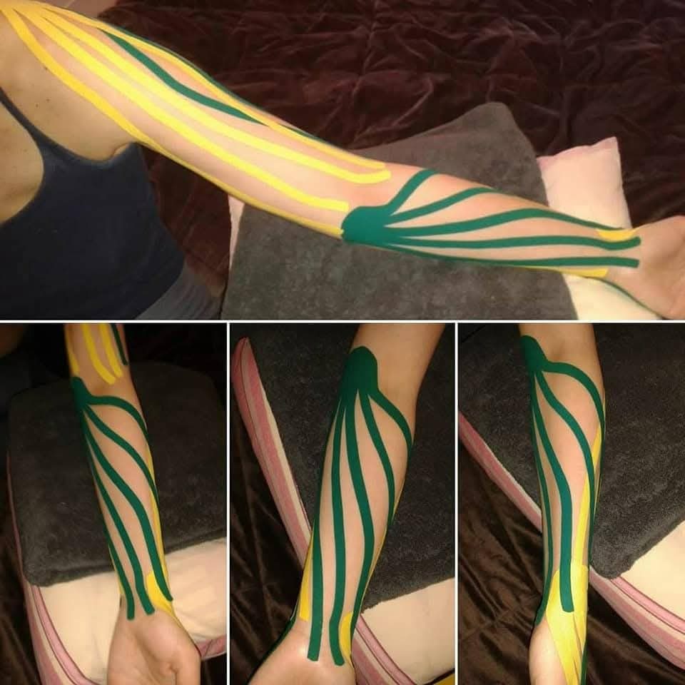 Kinezio taping - šaka