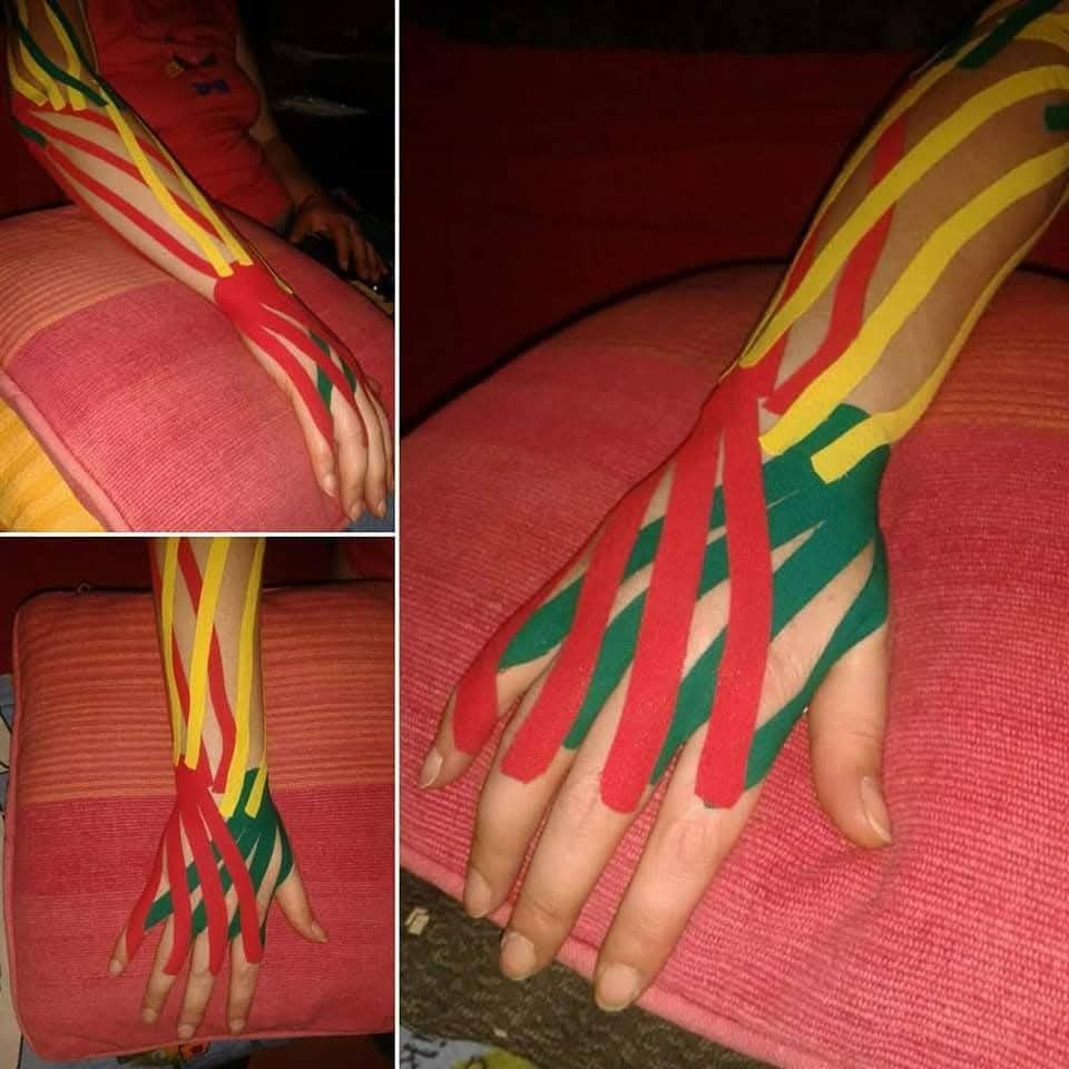 Kinezio taping - šaka detalj